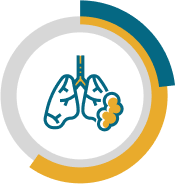 Pleurectomy/decortication (pleural mesothelioma) chart